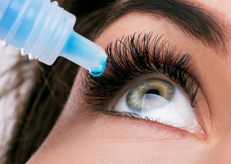 Woman taking medicated glaucoma eye drops